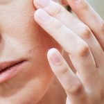 Managing Eczema Tips for Soothing Irritated Skin