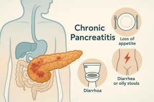 Pancreas illustration highlighting chronic pancreatitis impact on daily life and health management